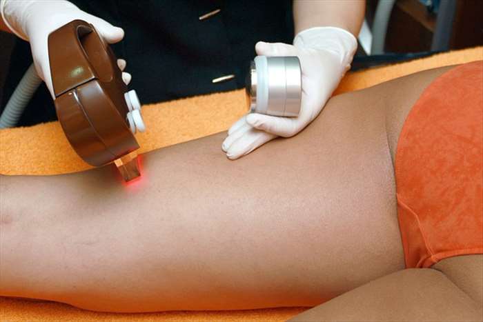 Pourquoi opter pour une épilation à la lumière pulsée??